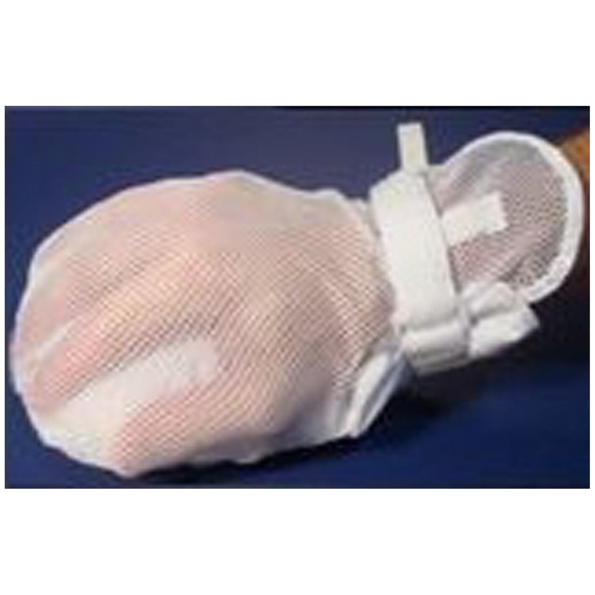 Marketlab Medi-Tech International Protective Mitts - Adult (Mesh Back, No Finger Separators, Essential Secure)
