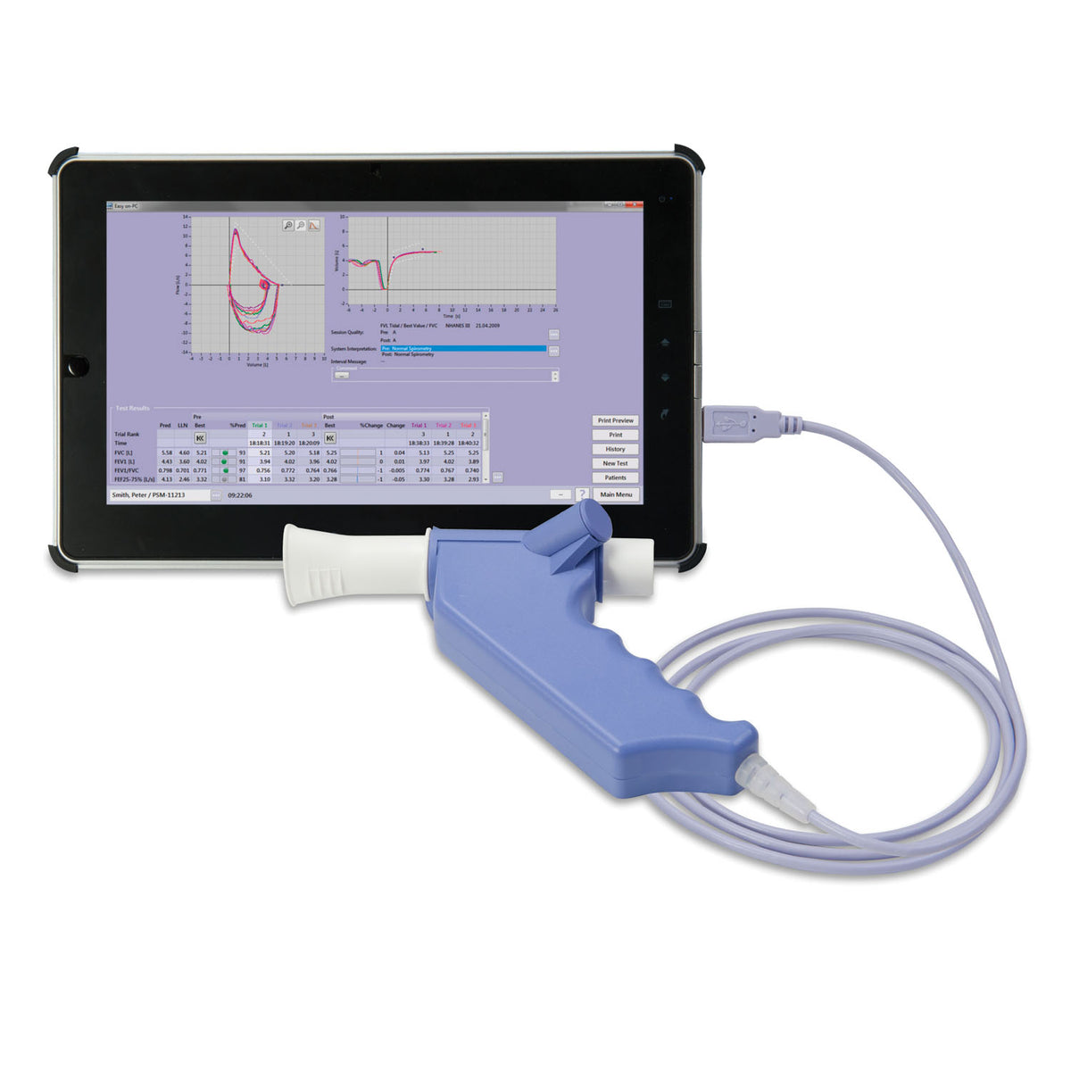 NDD Easy On-PC Spirometry System