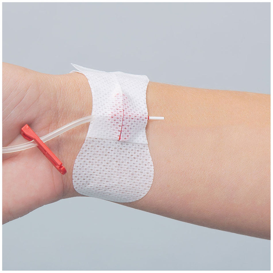 Tidi Grip-Lok Arterial Catheter Securement Device - Universal Winged Peripheral IV & Catheter