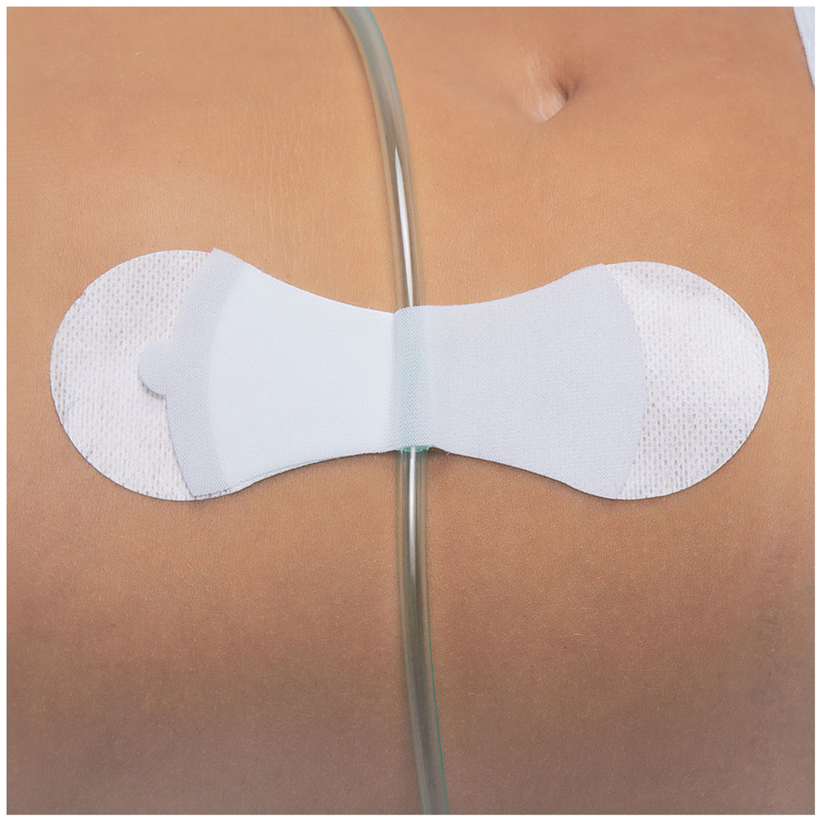 Tidi Grip-Lok Universal Securement Device – image 3
